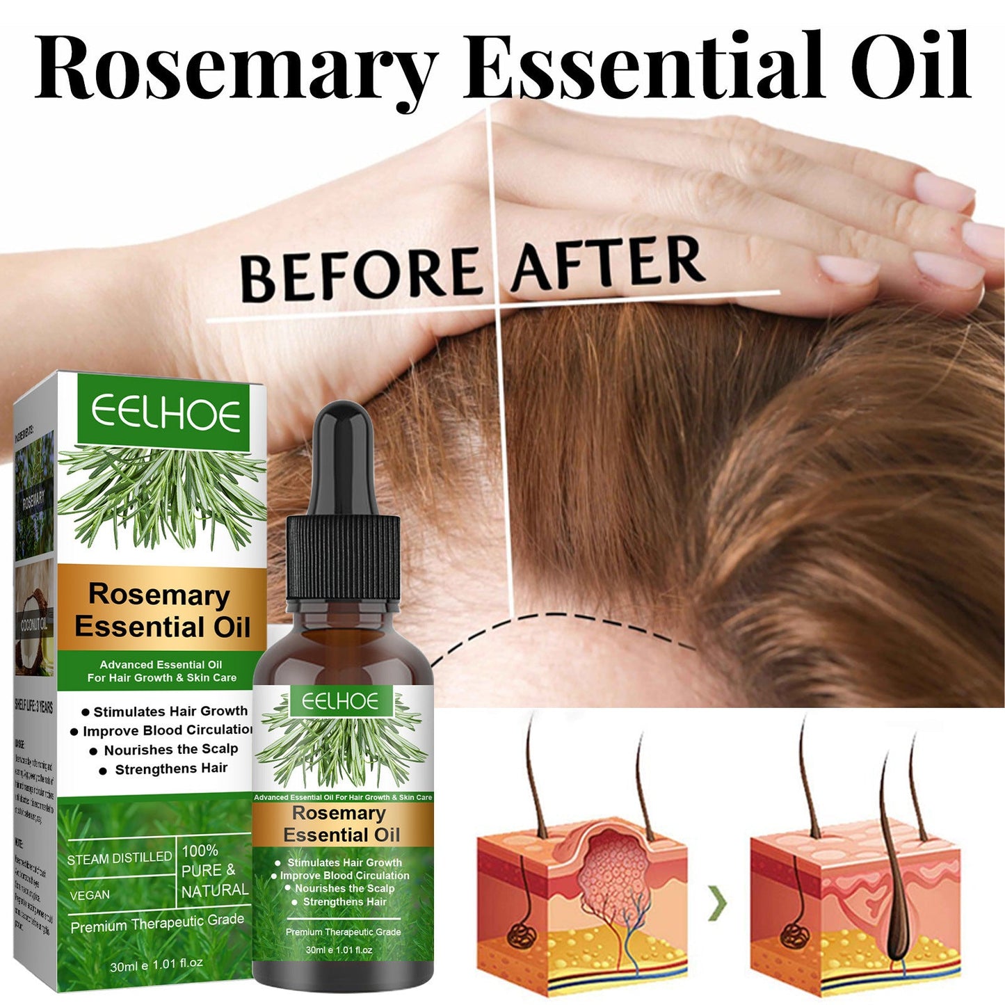 Rosemary Hair Growth Oil - Free 🎁